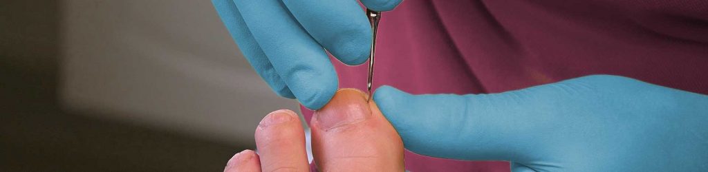 Nail cutting
